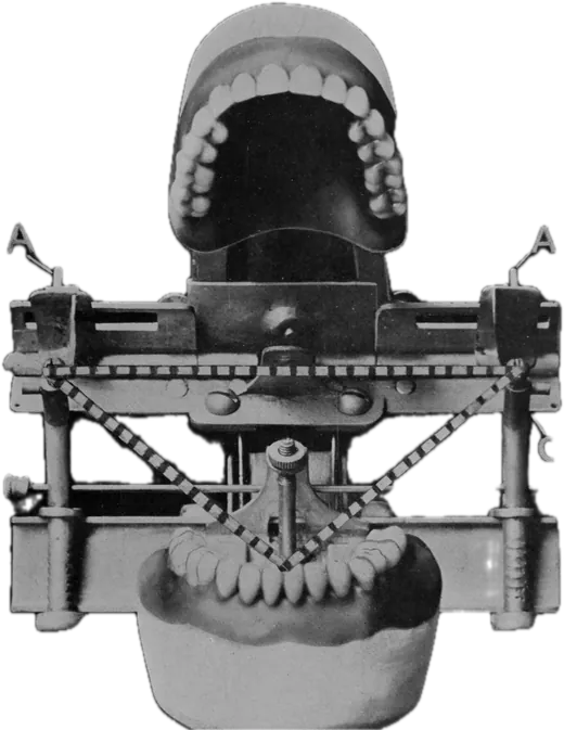Articulator vechi cu modele de ghips și dinți montați, fotografie din revista The Dental Cosmos, 1914